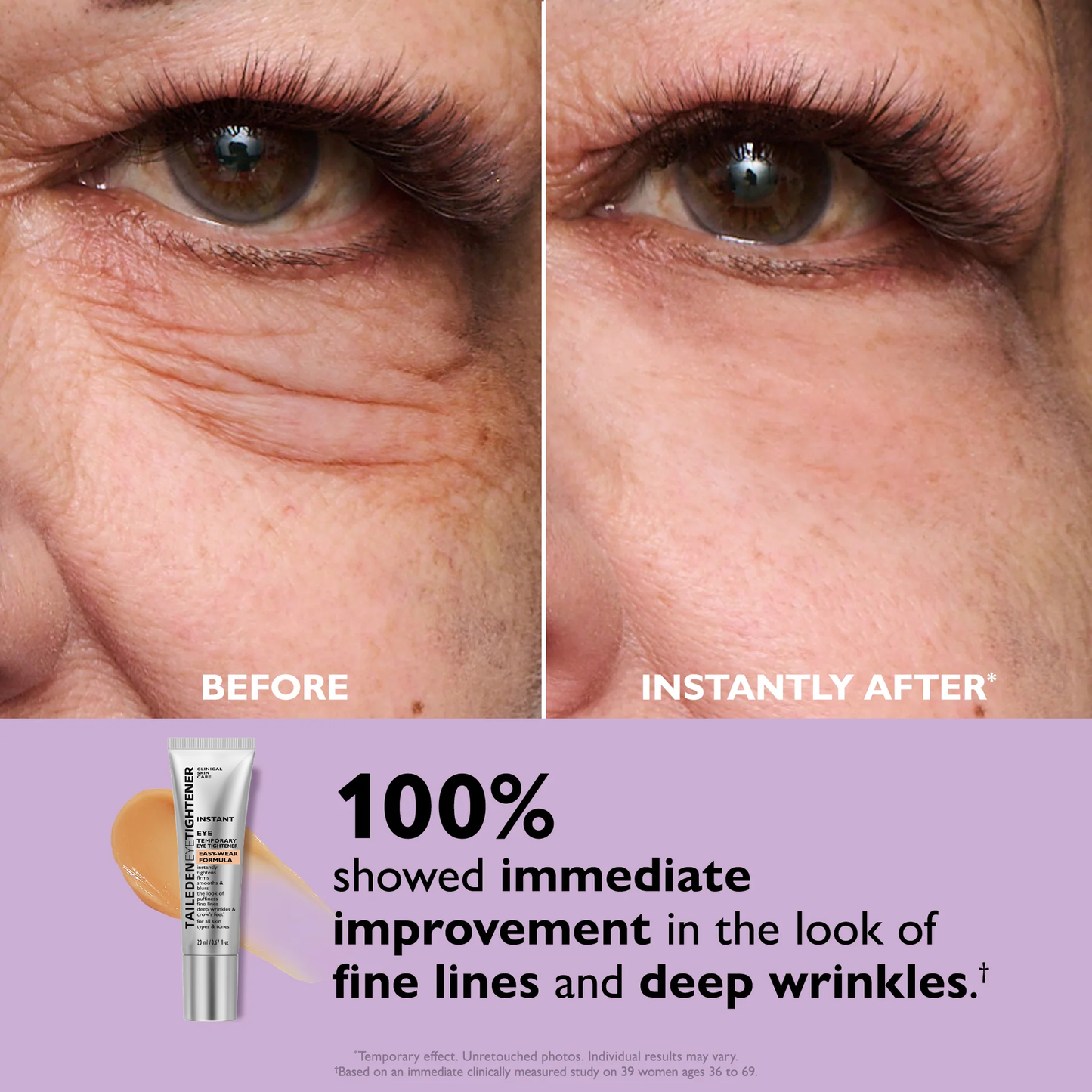 🔥Last Day 49% OFF No-Filter Eye Tightener