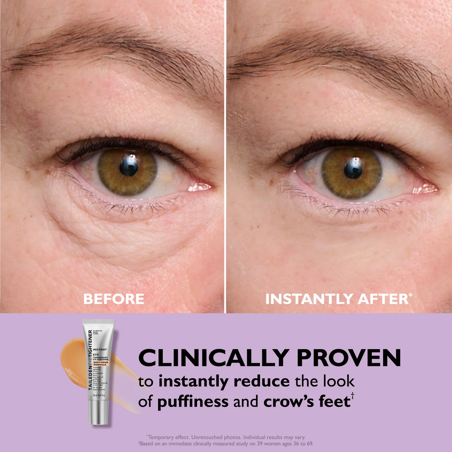 🔥Last Day 49% OFF No-Filter Eye Tightener