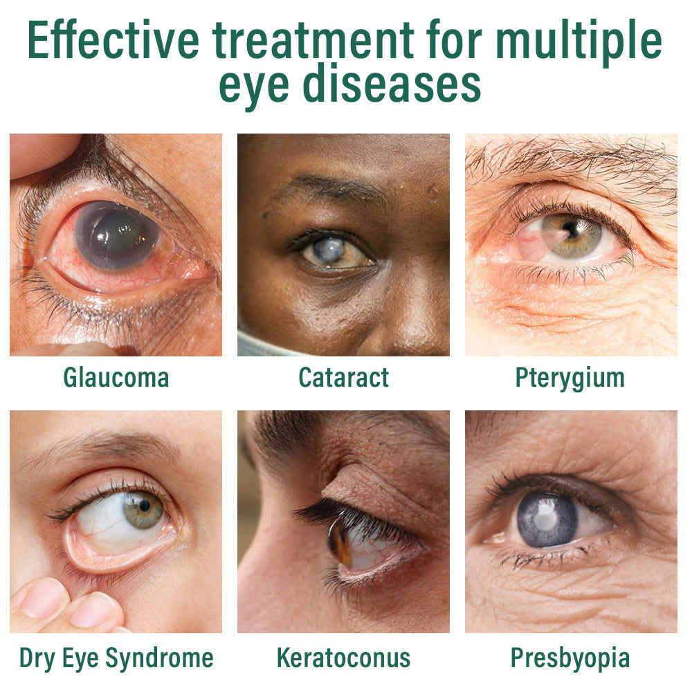 👩⚕️LBMLBM® Nano Eye Drops Serum ✅FDA Approved(Suitable for presbyopia, dry eye syndrome, glaucoma, and cataracts) 🌻