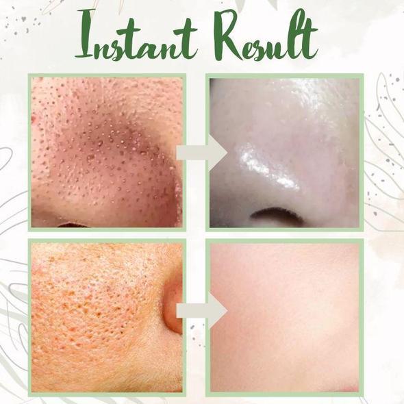 Green Tea Deep Cleanse Mask - (Limited time discount 🔥 last day)