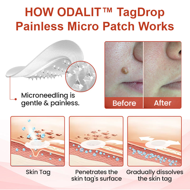 đĽODALIT⢠painless micro-patchđĽ