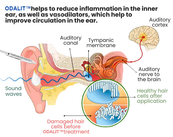 šODALIT⢠Tinnitus Relief Ear Dropsš„