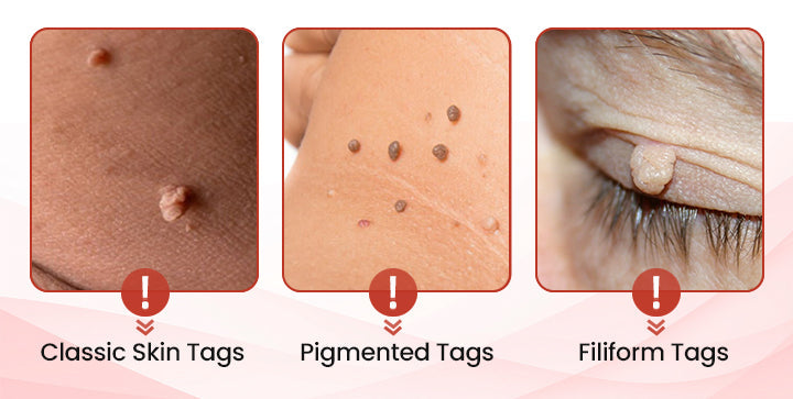 đĽODALIT⢠painless micro-patchđĽ