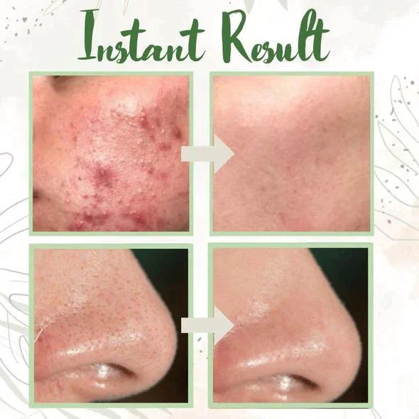 Green Tea Deep Cleanse Mask - (Limited time discount 🔥 last day)
