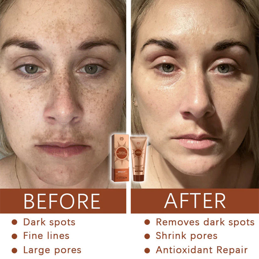 ODALITβ’ Herbal Spots β
π€ππ§π π¦π‘ π₯π ππ% Peel-Off Facial Mask
