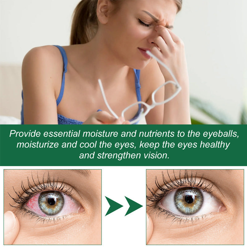 2025 Negusy Presbyopia Eye Drops