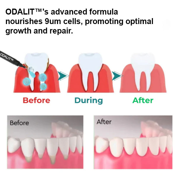 šš¦·ODALIT⢠Gum Therapy Agentš„