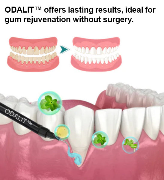 šš¦·ODALIT⢠Gum Therapy Agentš„
