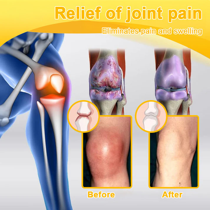 🔥Time-Limited Offer - ODALIT™ Botulinum Toxin & Bee Venom Pain-Relief Bone Healing Cream🐝💎