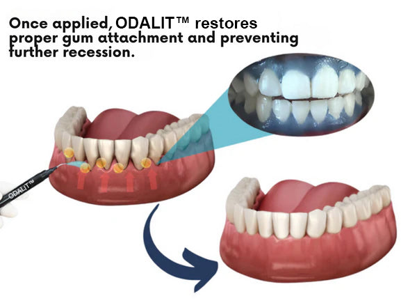 šš¦·ODALIT⢠Gum Therapy Agentš„