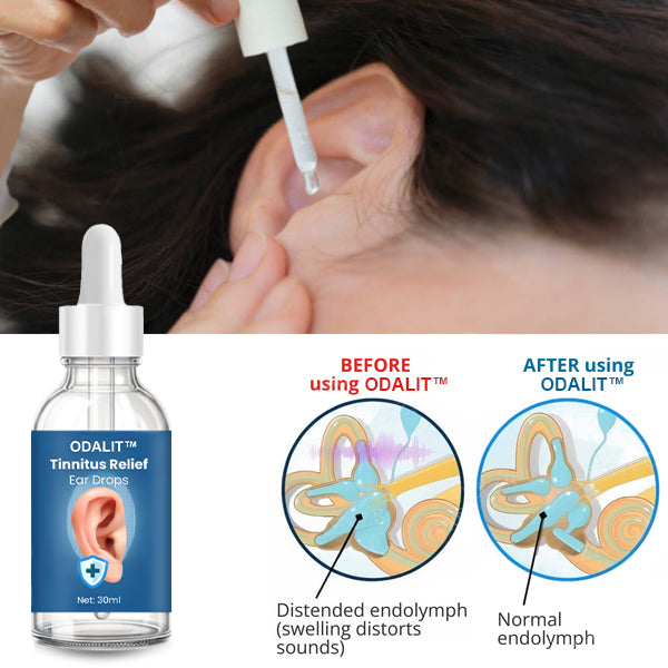 šODALIT⢠Tinnitus Relief Ear Dropsš„