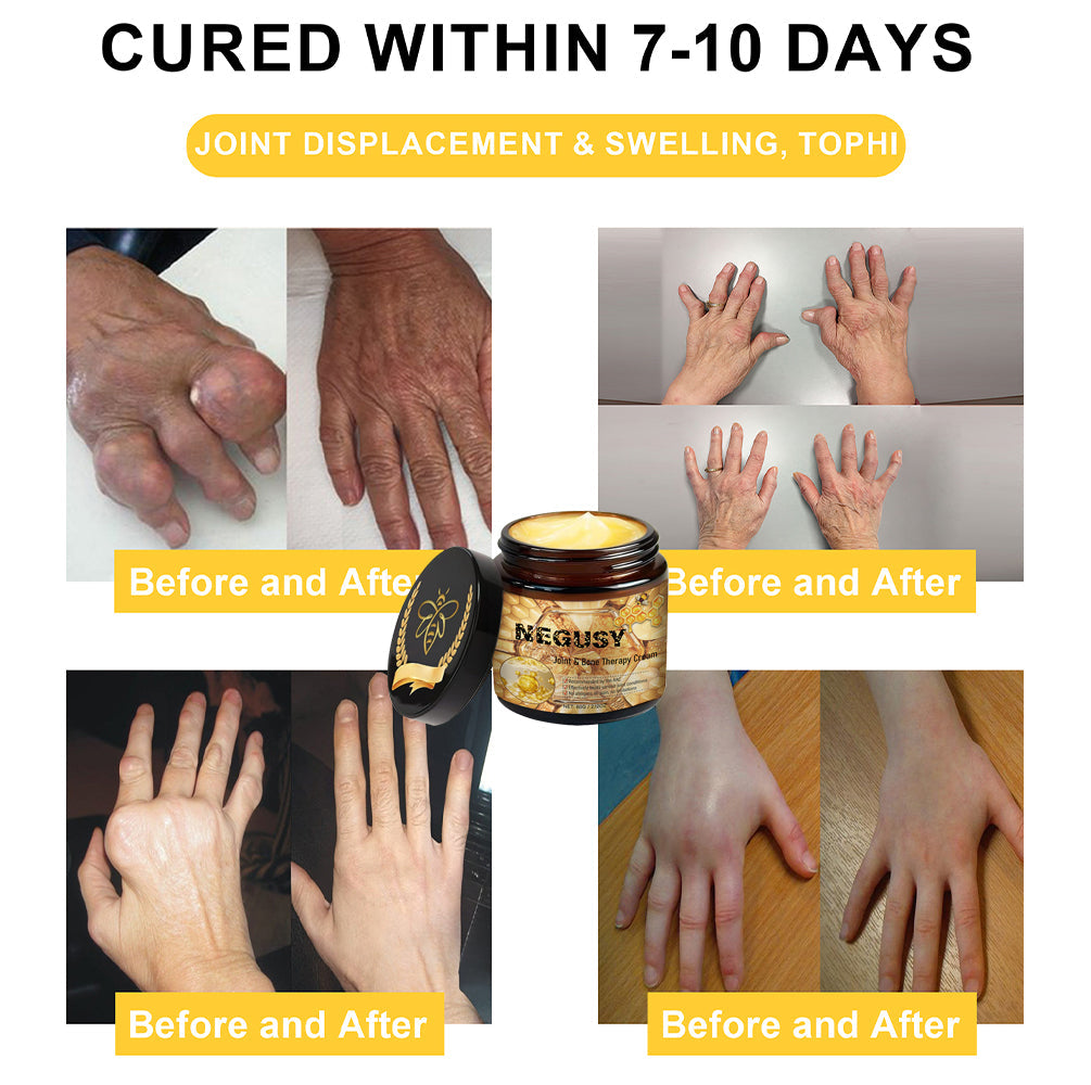 đQuick natural repair for sciatica, knee and back painđ