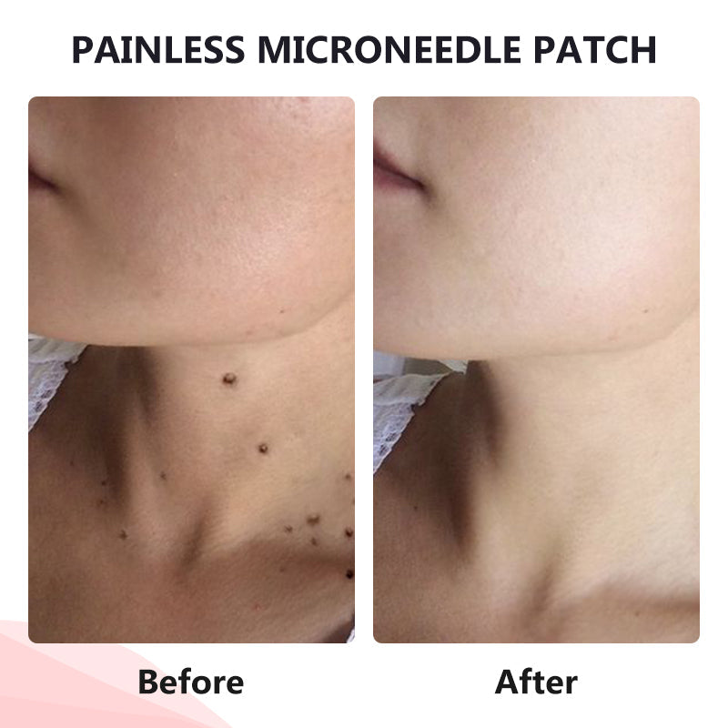 💥ODALIT™ painless micro-patch🔥🔥