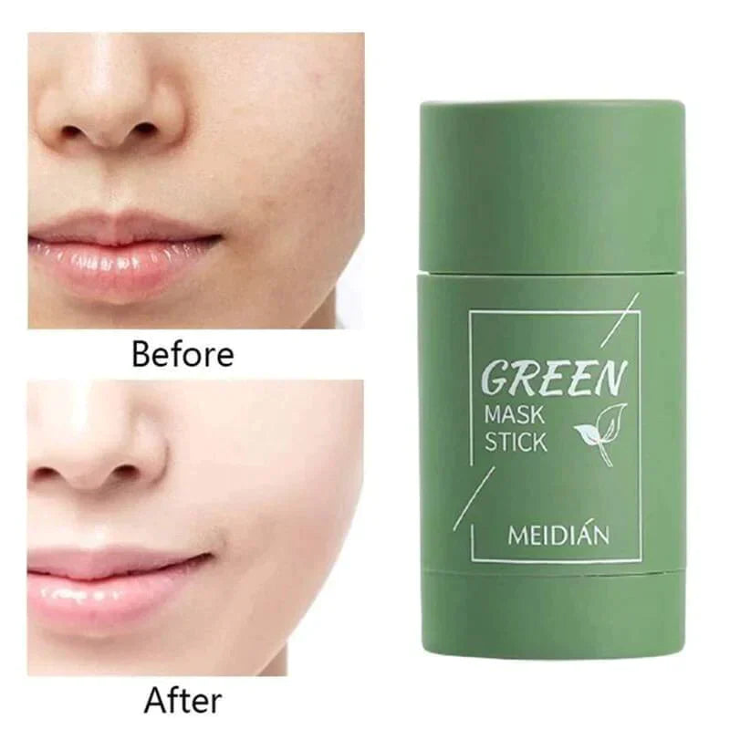 Green Tea Deep Cleanse Mask - (Limited time discount 🔥 last day)