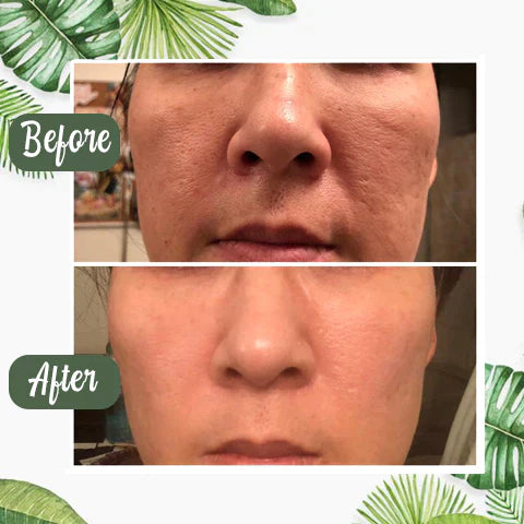 Green Tea Deep Cleanse Mask - (Limited time discount 🔥 last day)