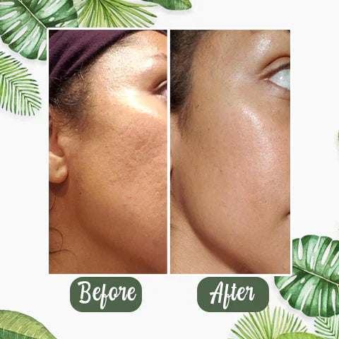 Green Tea Deep Cleanse Mask - (Limited time discount 🔥 last day)