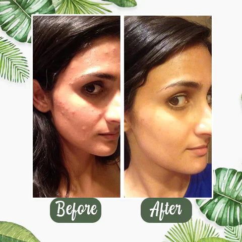 Green Tea Deep Cleanse Mask - (Limited time discount 🔥 last day)
