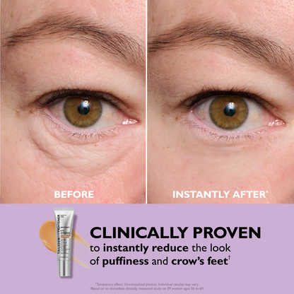 🔥Last Day 49% OFF No-Filter Eye Tightener