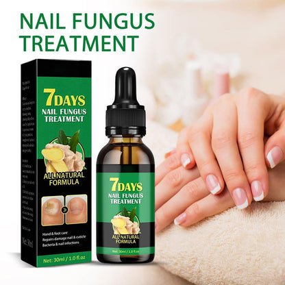 💅Refuse nail rot, ginger nail treatment👣