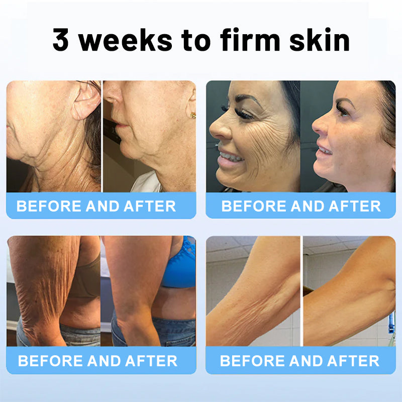 🐝ODALIT™ Bee Venom Skin Firming Stick✨