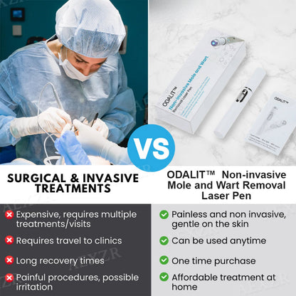 💥ODALIT™ Non-Invasive Mole and Wart Removal Laser Pen🔥