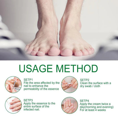 💅Refuse nail rot, ginger nail treatment👣