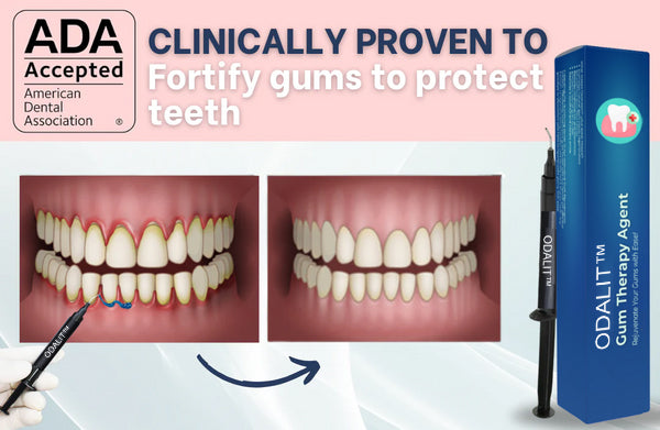 💖🦷ODALIT™ Gum Therapy Agent🔥