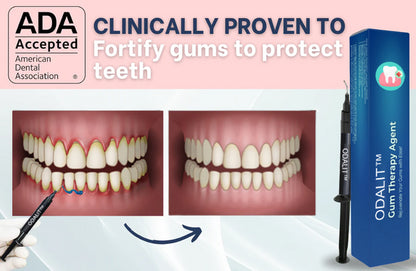 💖🦷ODALIT™ Gum Therapy Agent🔥
