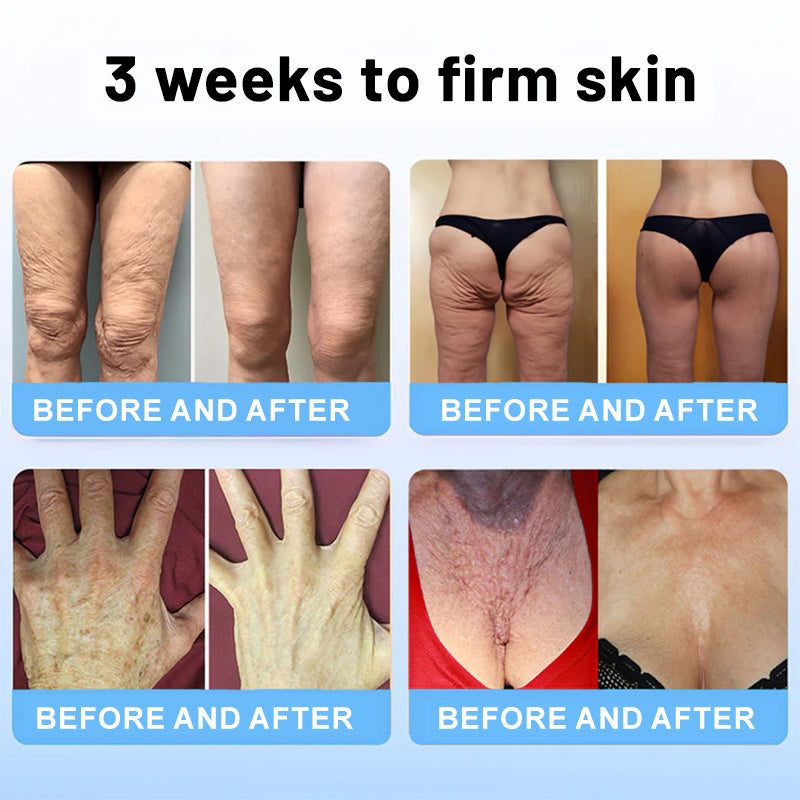 🐝ODALIT™ Bee Venom Skin Firming Stick✨