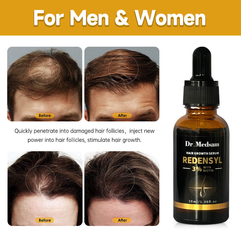 ✨Natural hair regrowth gel✨