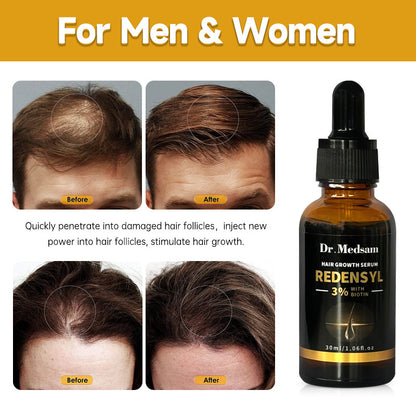 ✨Natural hair regrowth gel✨