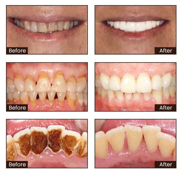 🦷ODALIT™Toothpaste