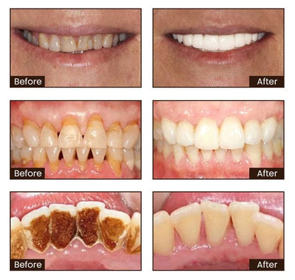 🦷ODALIT™Toothpaste